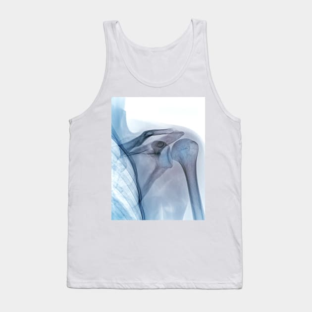 Shoulder joint, X-ray (C040/3239) Tank Top by SciencePhoto